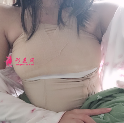 上海喜美整形醫(yī)院王會(huì)勇自體脂肪隆胸案例 上海喜美整形醫(yī)院王會(huì)勇自體脂肪隆胸案例