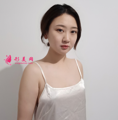 隆胸