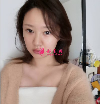 隆胸