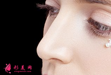 假體隆鼻手術(shù)會(huì)影響鼻子健康嗎
