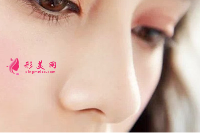 假體隆鼻手術(shù)包膜攣縮要不要取出來
