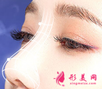 假體隆鼻手術(shù)包膜攣縮要不要取出來?
