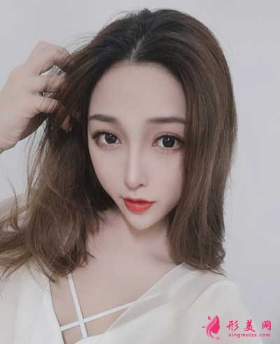 去北京麗都找曹衛(wèi)華醫(yī)生做鼻綜合整形手術(shù)后25天