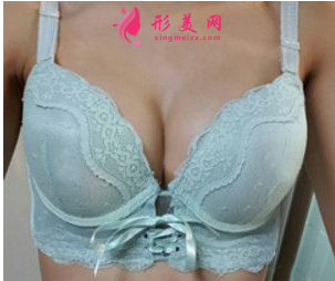 上海美聯(lián)臣整形醫(yī)院隆胸誰做的好？裴仁鎬假體隆胸90天效果很不錯(cuò)