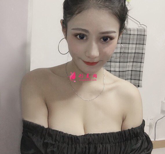 西安瑞麗郭永華醫(yī)師真人案例 隆胸90天前后對比圖分享
