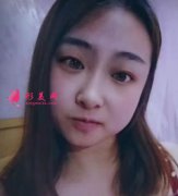 北京米揚(yáng)麗格巫文云隆鼻案例反饋，五官立體更上鏡了！