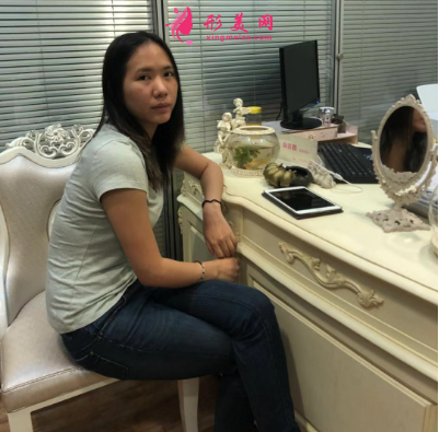 上海喜美整形醫(yī)院王會勇自體脂肪隆胸案例 上海喜美整形醫(yī)院王會勇自體脂肪隆胸案例