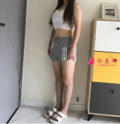 上海瑞芙臣馬昌華做大腿吸脂，雙腿變美短褲短裙任性穿