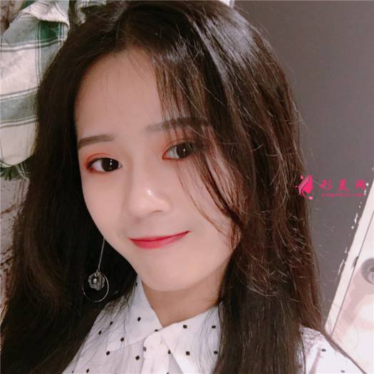 理想中的自己的整形術(shù)后圖片