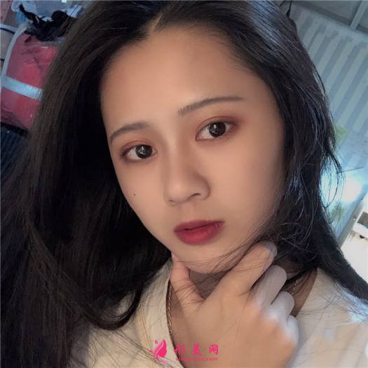 理想中的自己的整形術(shù)后圖片