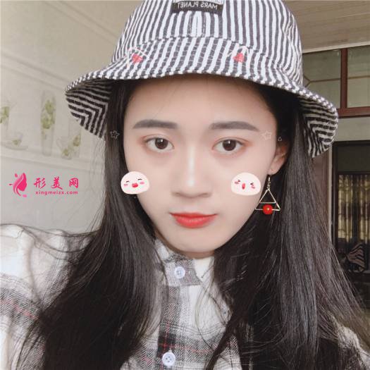 理想中的自己的整形術(shù)后圖片