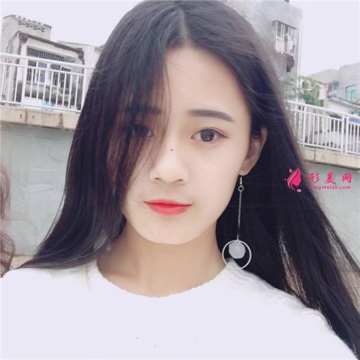 理想中的自己的整形術(shù)后圖片