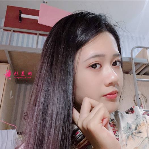 理想中的自己的整形術(shù)后圖片