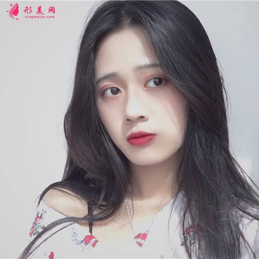 理想中的自己的整形術(shù)后圖片