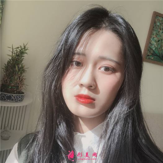 理想中的自己的整形術(shù)后圖片