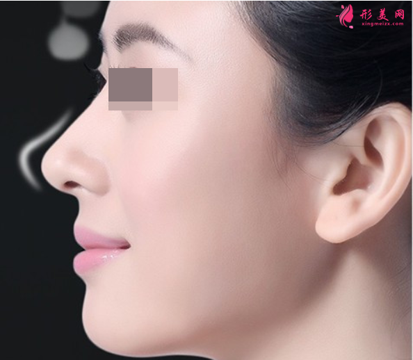 哪里隆鼻做得比較好呢