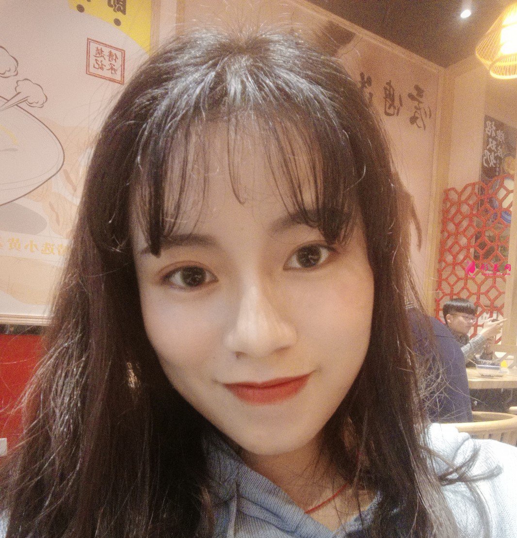 瘦臉吸脂手術(shù)后第15天