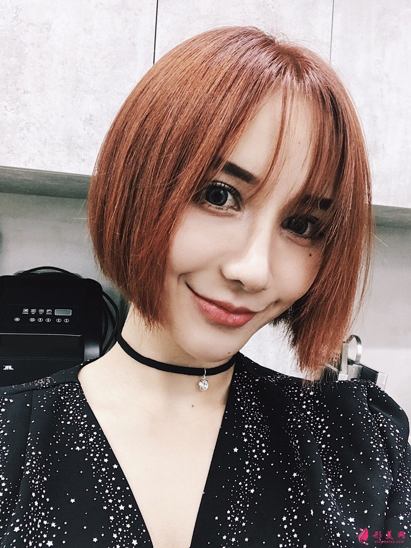 黑眼圈如何去除？填充玻尿酸淚溝+黑眼圈一步解決