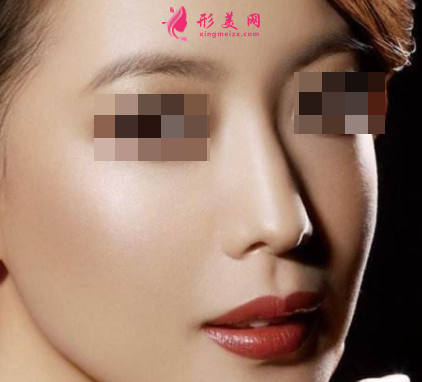 做隆鼻手術(shù)會(huì)不會(huì)影響呼吸