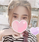 全切雙眼皮40天恢復(fù)圖全過程分享 小仙女蛻變?nèi)沼?></a><p class=