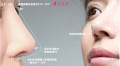 做假體隆鼻的價(jià)格貴不貴？