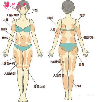 吸脂減肥后多久可以消腫