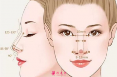 假體隆鼻會(huì)出現(xiàn)包膜攣縮嗎？