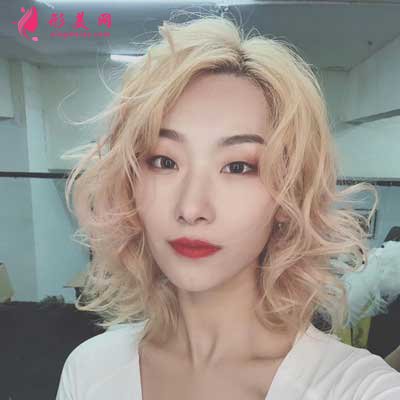 成都恒博植發(fā)術后72天圖片
