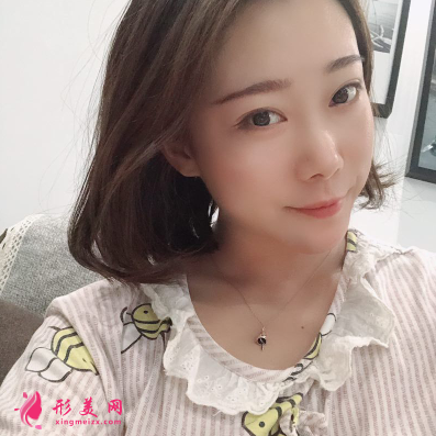 韓緣聚美做水氧活膚怎么樣呢？案例30天術(shù)后效果真的好極了