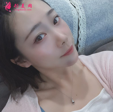 韓緣聚美做水氧活膚怎么樣呢？案例30天術(shù)后效果真的好極了