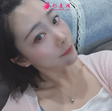 韓緣聚美做水氧活膚怎么樣呢？案例30天術(shù)后效果真的好極了