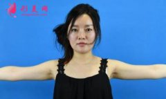 北大深圳醫(yī)院抽脂效果好不好，手臂吸脂后恢復效果分享