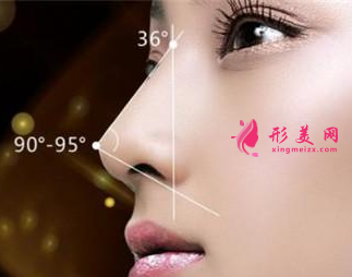 假體隆鼻后會(huì)不會(huì)變形