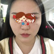 北京華韓整形醫(yī)院磨顴骨案例，讓我美美做新娘