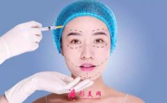 面部吸脂多久消腫恢復?消腫期間要注意什么?