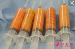 自體脂肪填充和玻尿酸填充哪個好？到底該選誰？