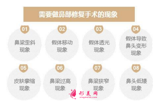 隆鼻失敗修復(fù)手術(shù)為何那么貴？