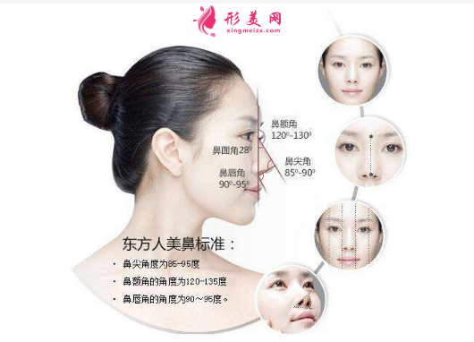 隆鼻失敗修復(fù)手術(shù)為何那么貴？