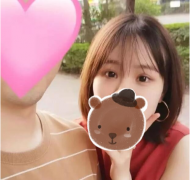 上海九院周一雄修復雙眼皮怎么樣？修復案例88天效果你喜歡嗎？