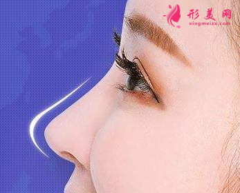 硅膠隆鼻需要多少錢