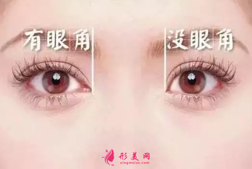 開(kāi)眼角一般是多少錢(qián)