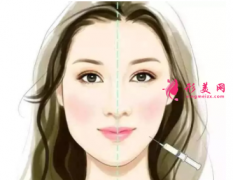 打瘦臉針注意事項(xiàng)是什么？