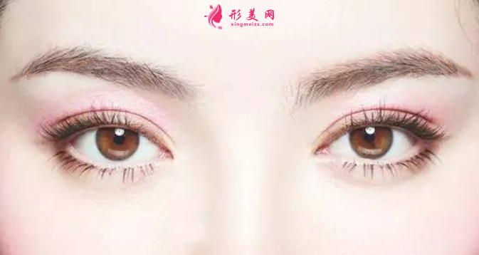 雙眼皮手術(shù)失敗修復(fù)難度大嗎