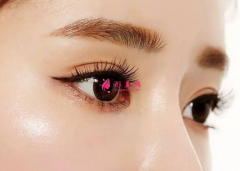 做雙眼皮手術(shù)的恢復(fù)時(shí)間？