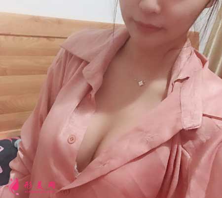 自體脂肪隆胸術(shù)后2個月