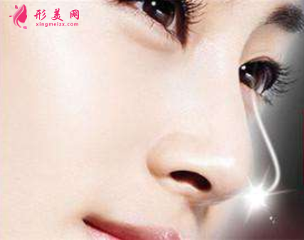 鼻翼縮小手術(shù)的恢復(fù)期長嗎