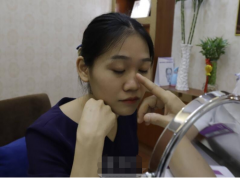 上海九院鼻子整形技術怎么樣？案例及效果圖一覽~