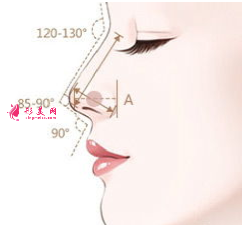 假體隆鼻有什么好處