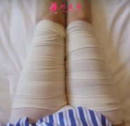 北京純脂大腿吸脂1-60天恢復(fù)經(jīng)驗分享+醫(yī)院口碑介紹