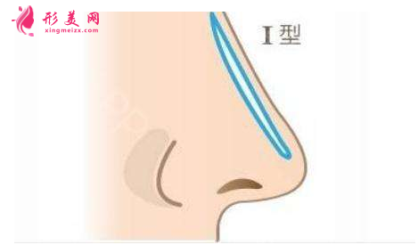 怎樣墊高鼻梁
